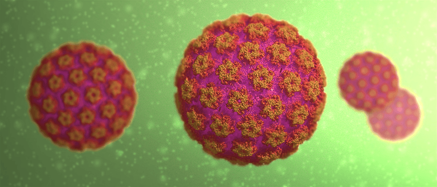 papillomavírus 3. stádiumú konizációja